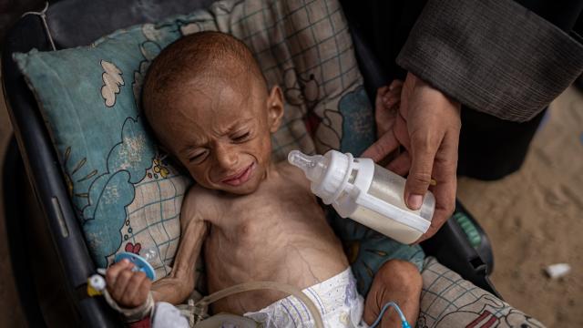 يونيسف: مقتل أكثر من 260 طفلاً في غزة خلال «الهدنة المزعومة» منذ أكتوبر